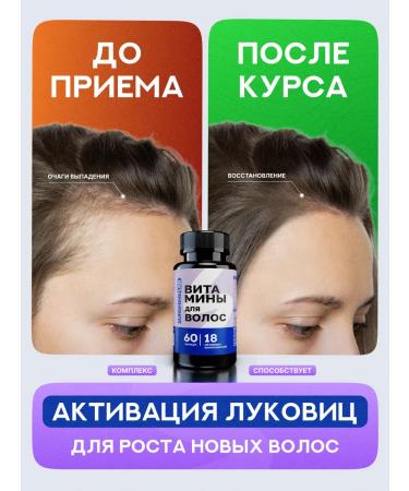 Sunshinelab Hair vitamins from falling out and growth - Buy Online on GoSupps.com