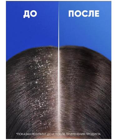 Head & Shoulders Hair dropping shampoo for women 400 ml - Buy Online on GoSupps.com