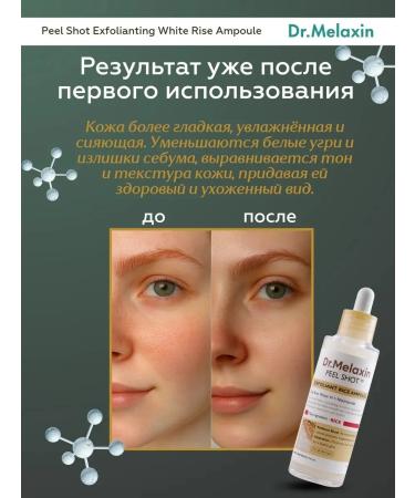 Pilling serum for skin radiance with rice extract - Buy Online on GoSupps.com