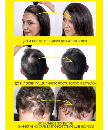 Sevich Hair thickener package (dark brown) 100 g - Buy Online on GoSupps.com