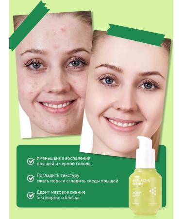 VOIS Facial serum with salicylic acid from acne - Buy Online on GoSupps.com