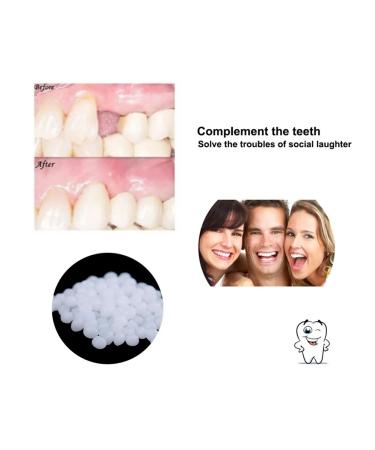 Handmade tooth adhesive 10 100 g gel for prostheses - Buy Online on GoSupps.com