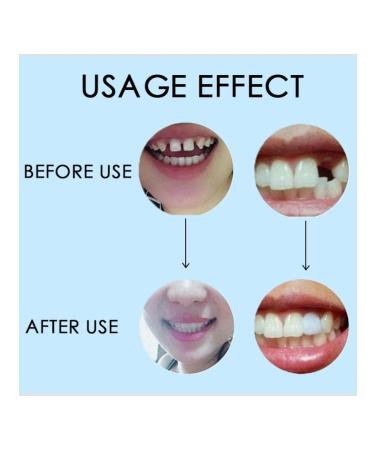 Handmade tooth adhesive 10 100 g gel for prostheses - Buy Online on GoSupps.com