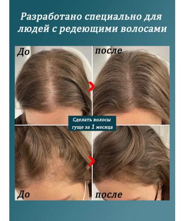 LYDIMOON Hair shampoo against hair loss 300 ml 3 bottles - Buy Online on GoSupps.com