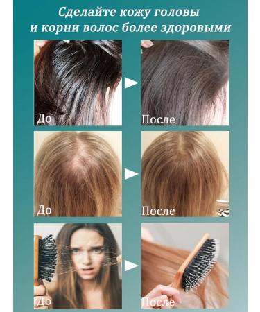 LYDIMOON Hair shampoo against hair loss 300 ml 3 bottles - Buy Online on GoSupps.com