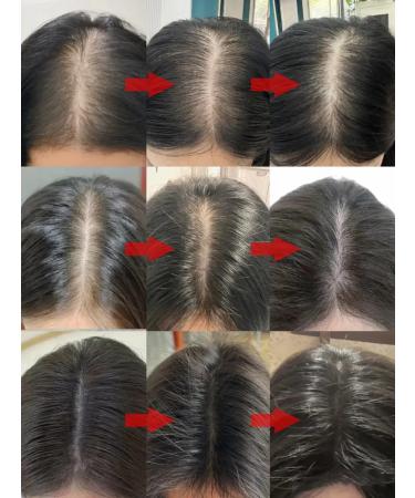 LYDIMOON Hair shampoo against hair loss 300 ml 3 bottles - Buy Online on GoSupps.com