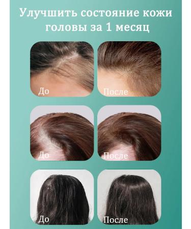 LYDIMOON Hair shampoo against hair loss 300 ml 3 bottles - Buy Online on GoSupps.com