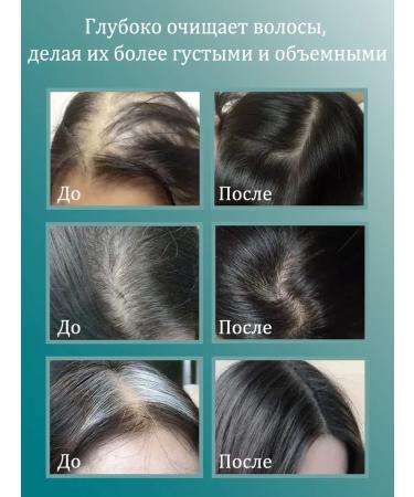 LYDIMOON Hair shampoo against hair loss 300 ml 3 bottles - Buy Online on GoSupps.com