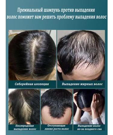 LYDIMOON Hair shampoo against hair loss 300 ml 5 bottles - Buy Online on GoSupps.com