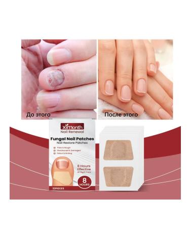 Nails moisturize the stickera to improve dry waterproof dryness - Buy Online on GoSupps.com