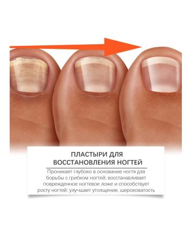 Nails moisturize the stickera to improve dry waterproof dryness - Buy Online on GoSupps.com