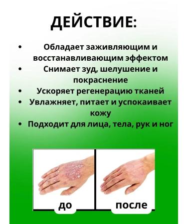 BigMix312 Chinese ointment from psoriasis healing restoring - Buy Online on GoSupps.com
