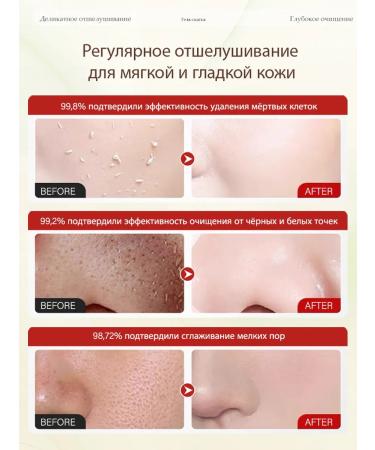 Facial peeling deleling deep cleansing 50 g - Buy Online on GoSupps.com