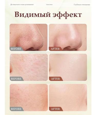 Facial peeling deleling deep cleansing 50 g - Buy Online on GoSupps.com