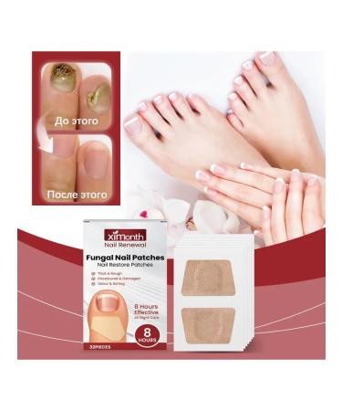Restorative nails Protective patch Eliminate fungi - Buy Online on GoSupps.com