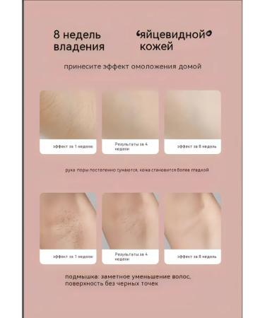 Mlay photoepator for hair removal 12j - Buy Online on GoSupps.com