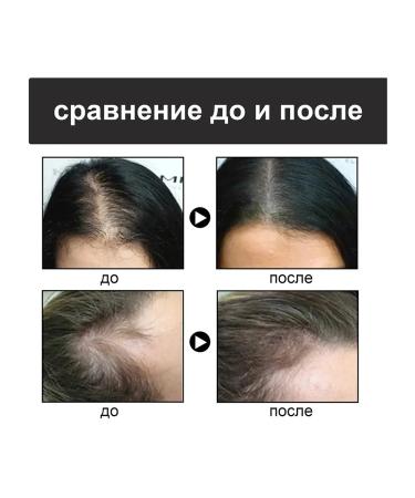 eelhoe hair fiber powder fill the waterproof vat form - Buy Online on GoSupps.com