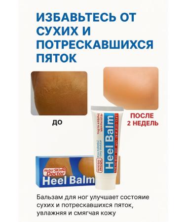 MIS31 cream-balm for the treatment of fungus and dry heels - Buy Online on GoSupps.com