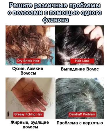 LYDIMOON Hair growth shampoo - Buy Online on GoSupps.com