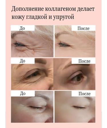 LYDIMOON Facial cream anti -aging - Buy Online on GoSupps.com