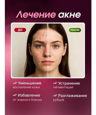 Uoco PhotoPisher Laser Professional - Buy Online on GoSupps.com