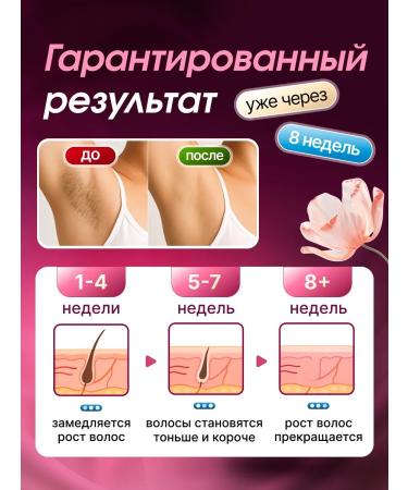 Uoco PhotoPisher Laser Professional - Buy Online on GoSupps.com