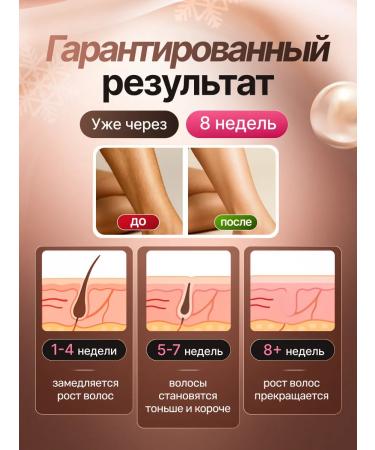 Uoco Laser photoepator for removing hair female - Buy Online on GoSupps.com