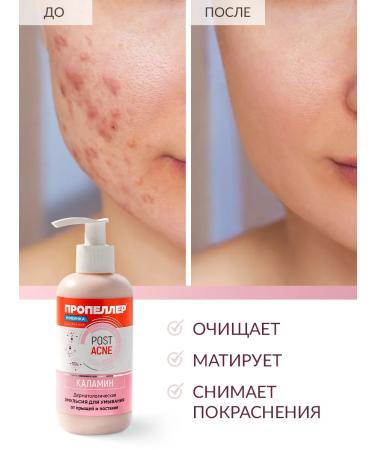 PROPELLER Washing gel "Emulsion Kalamin" from acne 200 ml - Buy Online on GoSupps.com