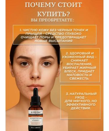 MOON2705 Lotion-serum for blackheads and acne in the face and nose area - Buy Online on GoSupps.com