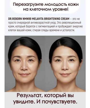 Dr Reborn NMN face cream from pigmentation and wrinkles (50 ml) - Buy Online on GoSupps.com