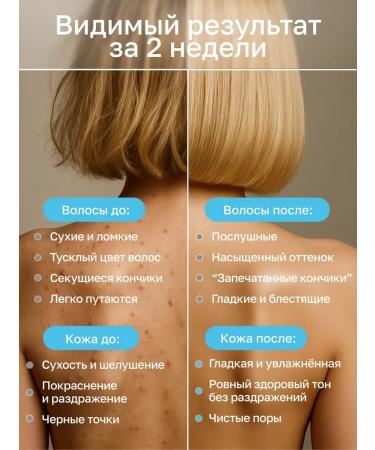 Archimedes Set of shampoo for hair growth and shower gel from acne - Buy Online on GoSupps.com