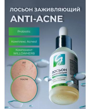 girlsss secret Facial lotion from acne