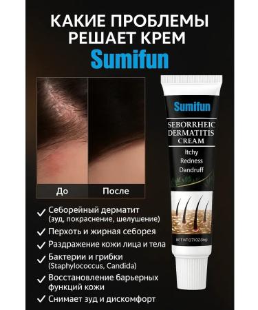 Bilioner W Cream for scalp from psoriasis and seborrhea - Buy Online on GoSupps.com