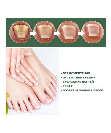 eelhoe Sterilization nail care solution soft clean restore - Buy Online on GoSupps.com