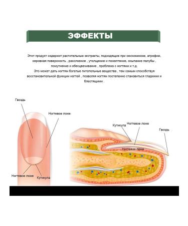 eelhoe Sterilization nail care solution soft clean restore - Buy Online on GoSupps.com