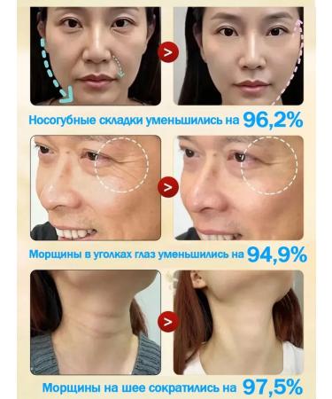 SADOER OFFICIAL Facial cream anti -aging - Buy Online on GoSupps.com