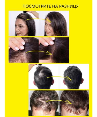 Sevich Hair thickener Powder for hair red-brown volume - Buy Online on GoSupps.com