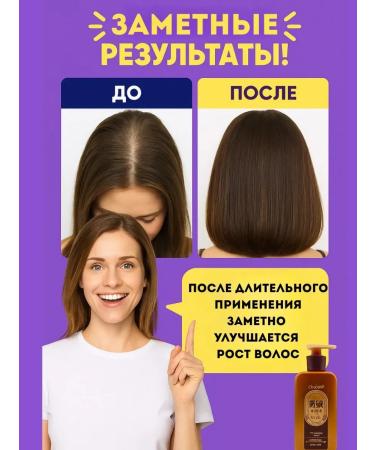 zozo Anti-hair loss shampoo - Buy Online on GoSupps.com