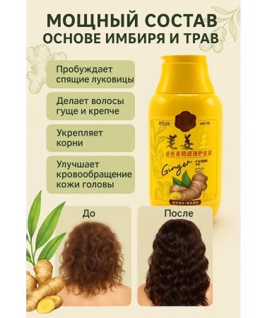 zozo Ginger hair loss with ginger