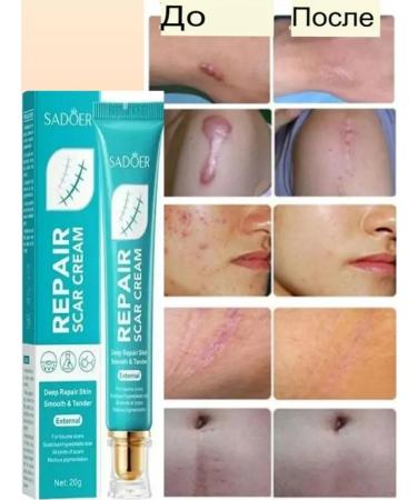 TAIS cream from scars and scars on the face and body - Buy Online on GoSupps.com