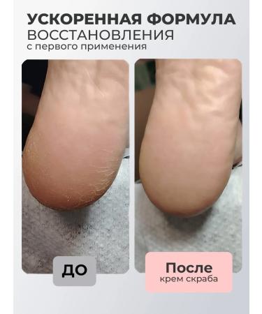 ROSILAK Set gel-peeling cream scrub for skin Professional - Buy Online on GoSupps.com