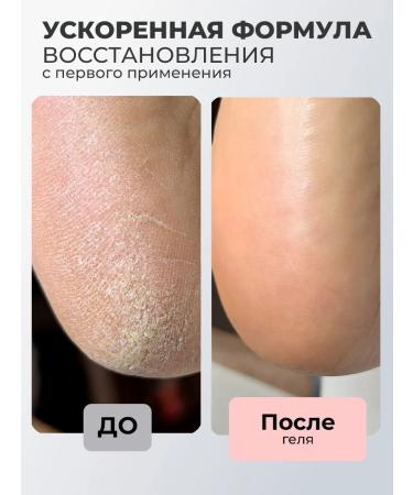 ROSILAK Set gel-peeling cream scrub for skin Professional - Buy Online on GoSupps.com