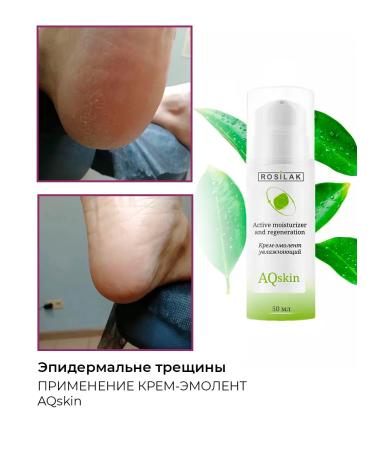 ROSILAK A set of products from dry peeling and cracks on the skin - Buy Online on GoSupps.com