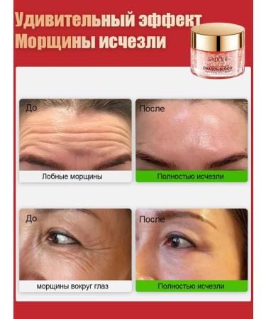 LYDIMOON Cream against wrinkles decongestant anti -aging 50 g - Buy Online on GoSupps.com