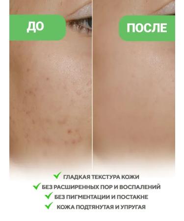 VT Cosmetics Booster-serum with microeles 300 50ml - Buy Online on GoSupps.com