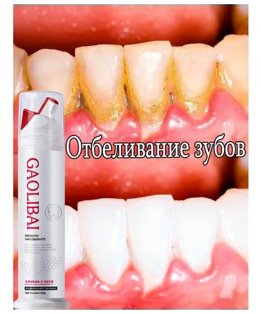 Toothpaste whitening with a probiotic
