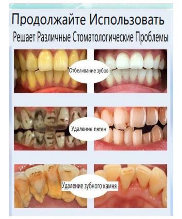 Toothpaste whitening with a probiotic - Buy Online on GoSupps.com