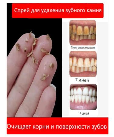 Toothpaste whitening with a probiotic - Buy Online on GoSupps.com
