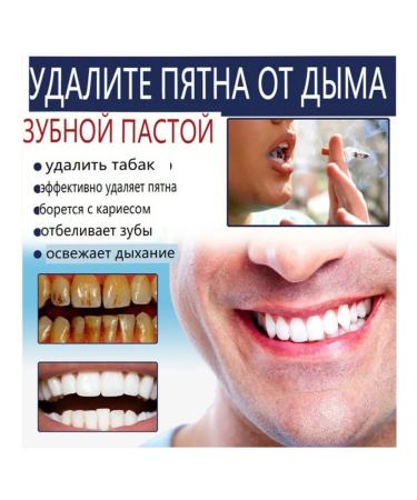 Toothpaste whitening with a probiotic - Buy Online on GoSupps.com