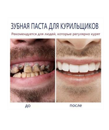 Toothpaste whitening with a probiotic - Buy Online on GoSupps.com